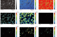 Application of Electron Probe Mioroanalyzer (EPMA) in Aluminum Alloy Microstructural Analysis